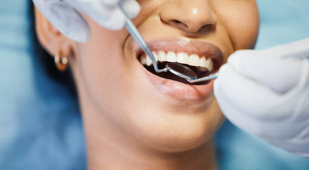 Best Emergency Treatment for Dental Infections or Abscesses in Bradford, PA